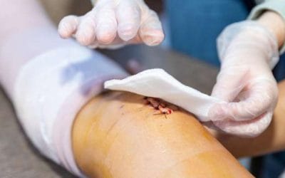 Krioszauna Budapest- gyorsabb felépülés műtét után 2 helyszínen