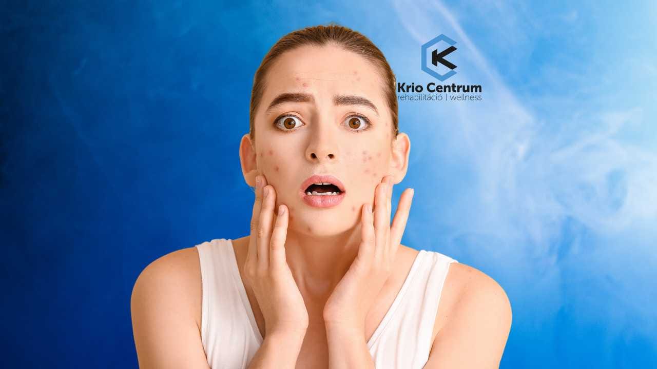 BŐRHIBÁK KEZELÉSE